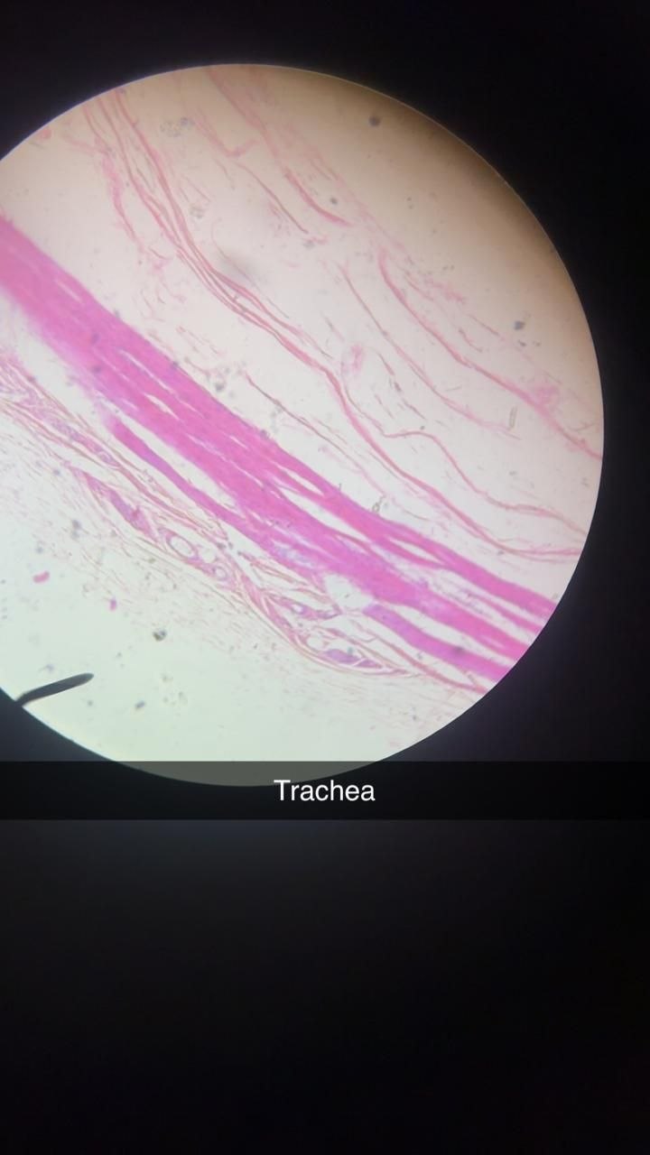 Trachea: microscope field