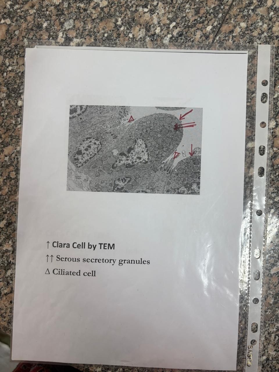 Club cell (Clara cell): TEM