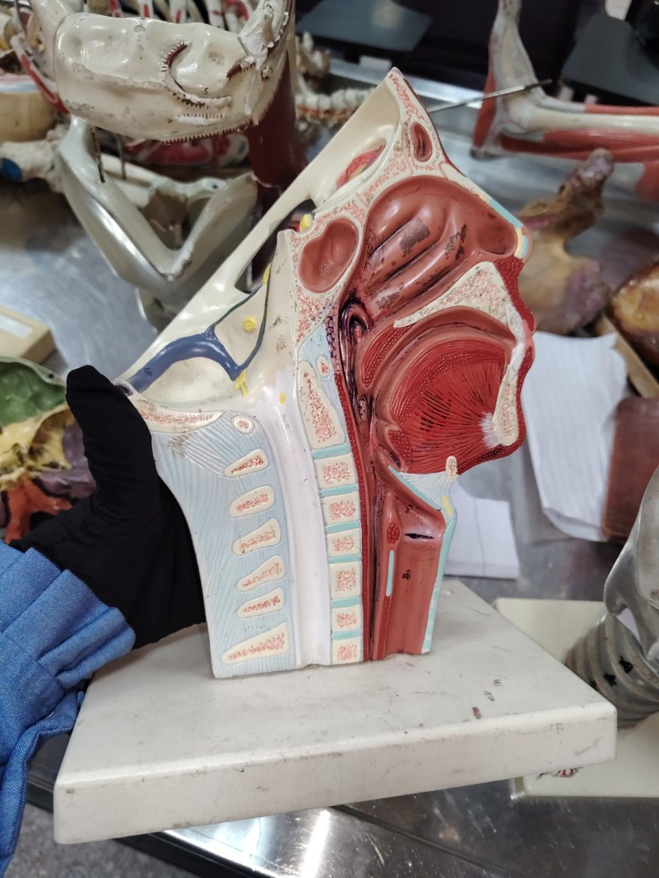 Sagittal head model: lateral nasal wall